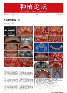 Implant Tribune China No. 3, 2017