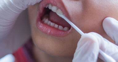 Fluoride varnish in primary dentition positively affects caries prevention