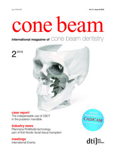 cone-beam-international-no-2-2016-0216