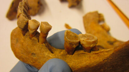 Study of medieval plaque shows how oral microbiomes have changed