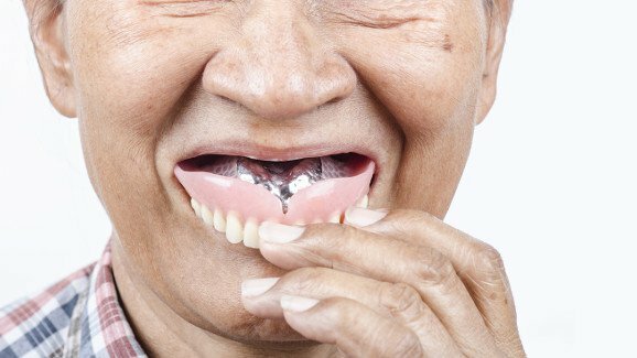 戴义齿入睡会增加高龄人群患肺炎的风险