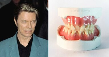 Rozhovor: „Bowieho zuby byly stejné jako vše, co se ho týká: jiné“