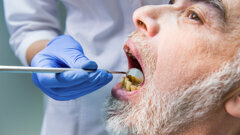 Dentists must prepare to treat growing numbers of elderly patients with “complex medical histories”