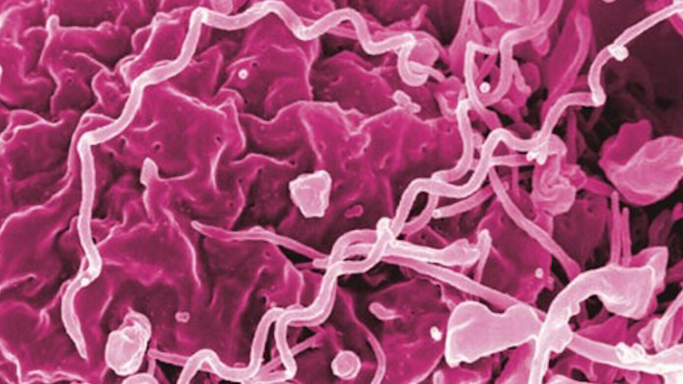 “The Great Imitator”: Resurgence of Syphilis and the Role of the Dental Provider in Diagnosis, Treatment, and Prevention.