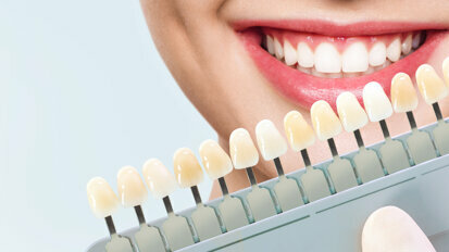 The Next Generation in Vital Tooth Whitening (Bleaching)
