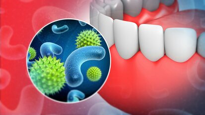 Bridging Microbial Ecology and Clinical Research to Optimize Periodontal Treatment and Prevent Implant and Restorative Failures