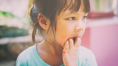 Dental Professionals: Identifying and Reporting Suspected Child Abuse