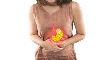Gastroesophageal Reflux Disease: Implications and Management