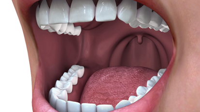 Oral Systemic Health