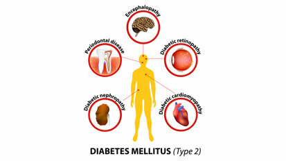Diabetes and Oral Disease