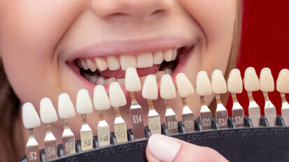 For Your Patients, Whitening Something New to Smile About