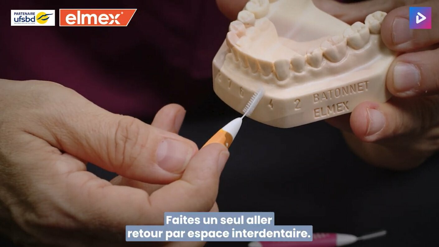 Retrouvez comment et dans quels cas utiliser les brossettes interdentaires.