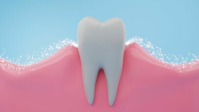 Duraphat® 5000 ppm Fluoride Toothpaste Boosts the Anti-Caries Effect of Saliva for 24 hours*