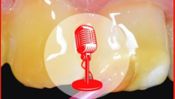 PODCAST - Episode 1. Le vernis fluoré, bouclier anti-caries indispensable