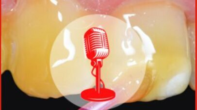 PODCAST - Episode 1. Le vernis fluoré, bouclier anti-caries indispensable