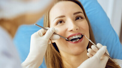 Fluoro e ortodonzia: prevenzione e gestione della carie