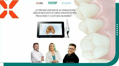 CYFROWE WSPARCIE W ODBUDOWIE ZĘBÓW BOCZNYCH ORAZ DIAGNOSTYKA PRÓCHNICY UŻYCIEM SKANERA