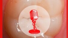 PODCAST - Episode 2. Les lésions carieuses radiculaires : nouveaux défis et stratégies