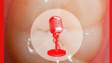 PODCAST - Episode 2. Les lésions carieuses radiculaires : nouveaux défis et stratégies