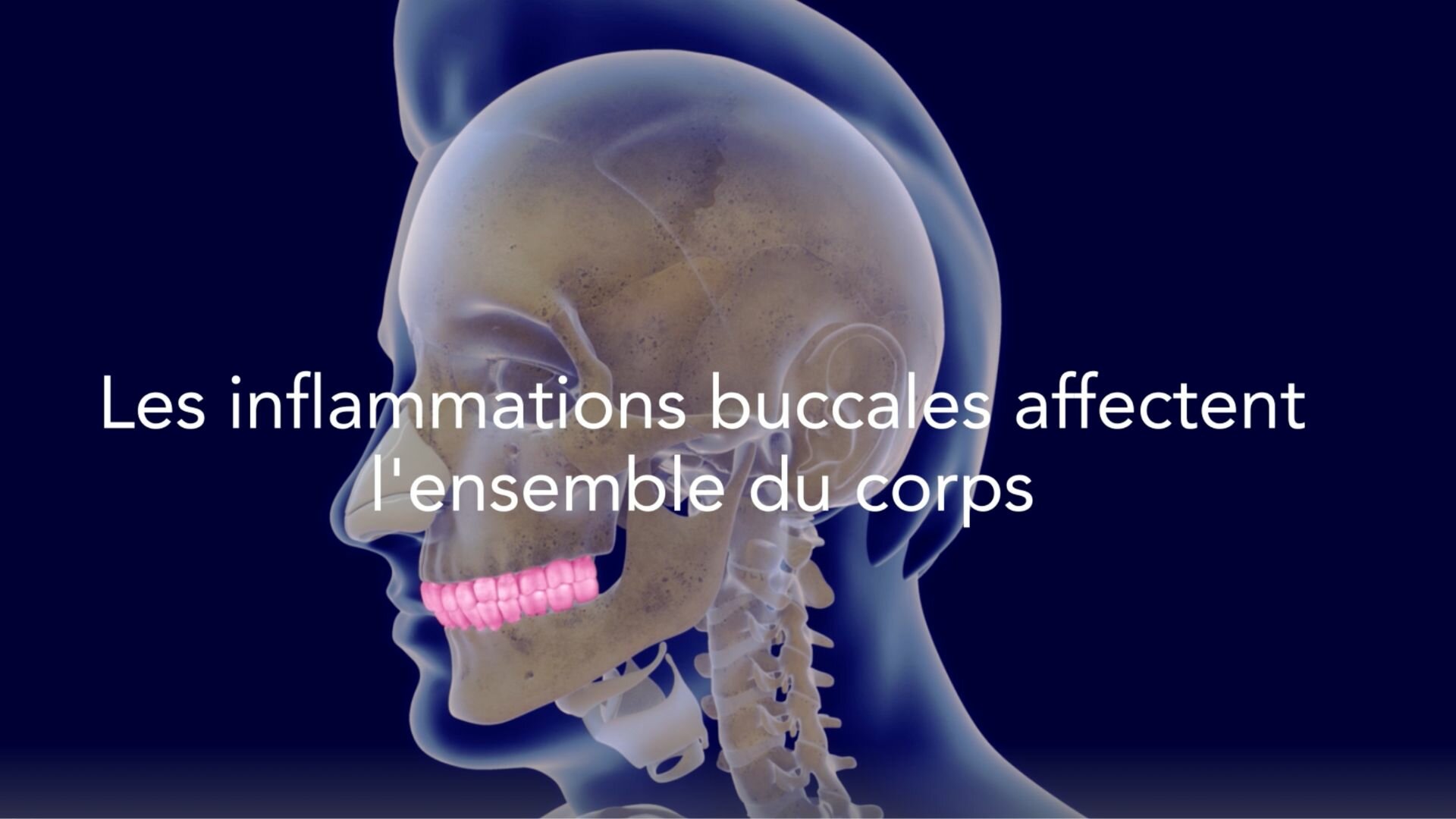 Santé bucco-dentaire - Vidéo explicative Swiss Dental Hygienists
