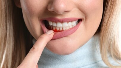 meridol® Protection gencives - formule amine et zinc