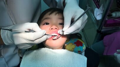 Dentisterie pédiatrique : Carie du biberon