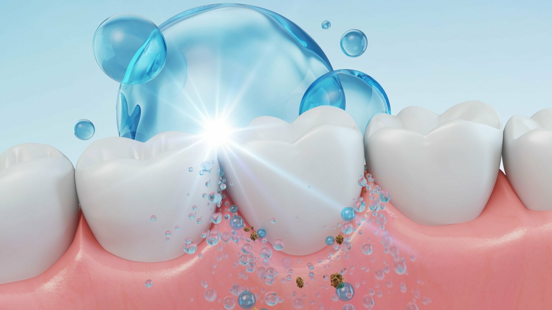 Infiammazione gengivale e controllo del biofilm