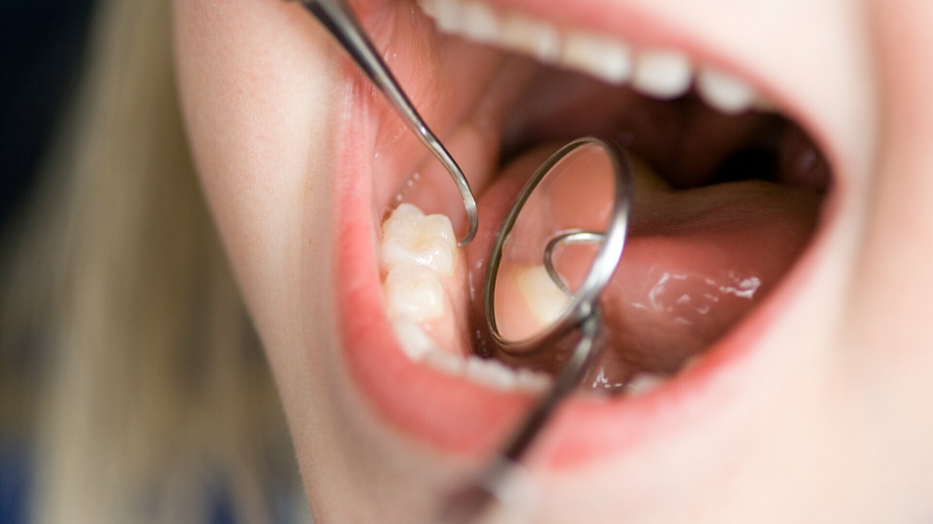  MIH- jedna choroba- wiele wyzwań