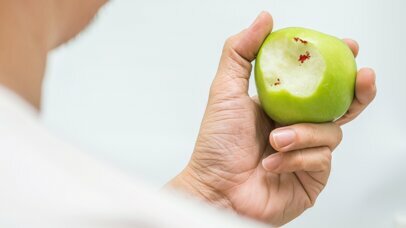 Zapalenie przyzębia dla początkujących- etiologia, podział, diagnostyka