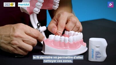 Retrouvez comment et dans quels cas utiliser le fil dentaire.