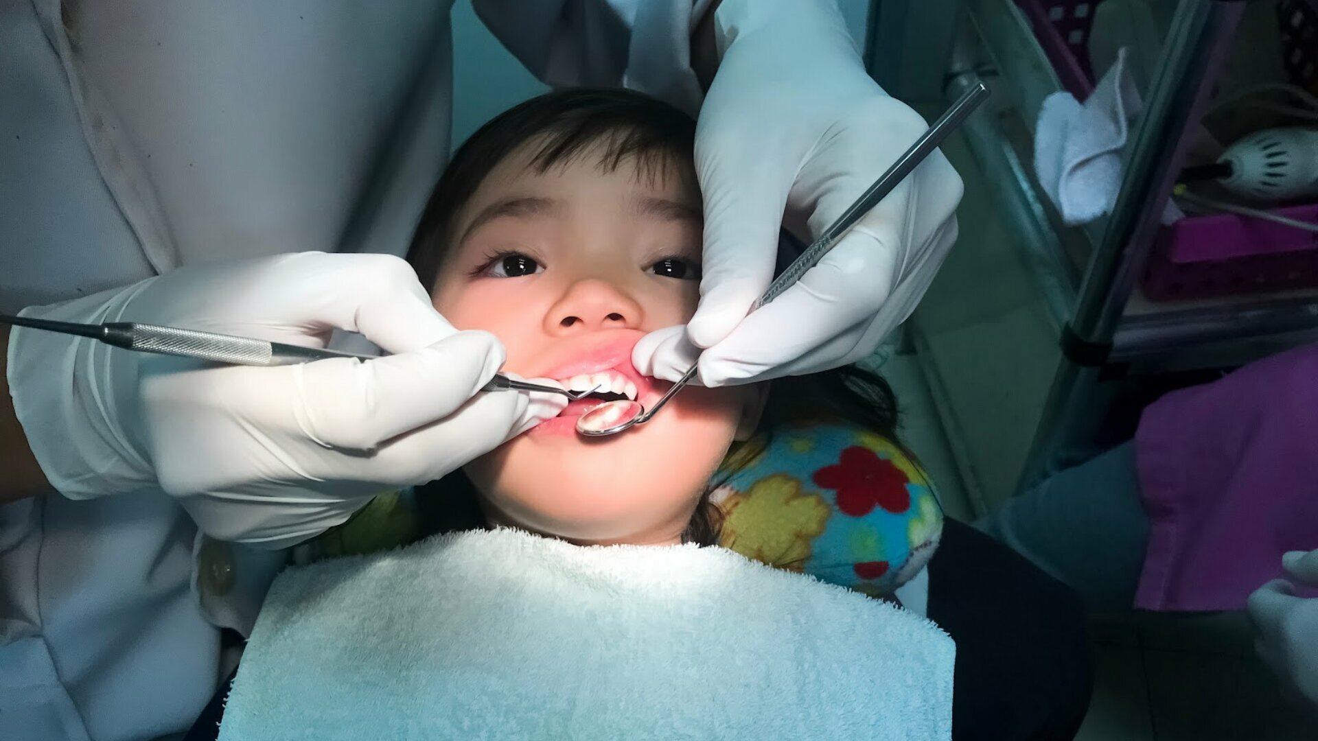 Dentisterie pédiatrique : Carie du biberon