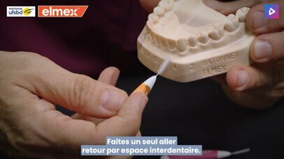 Retrouvez comment et dans quels cas utiliser les brossettes interdentaires.