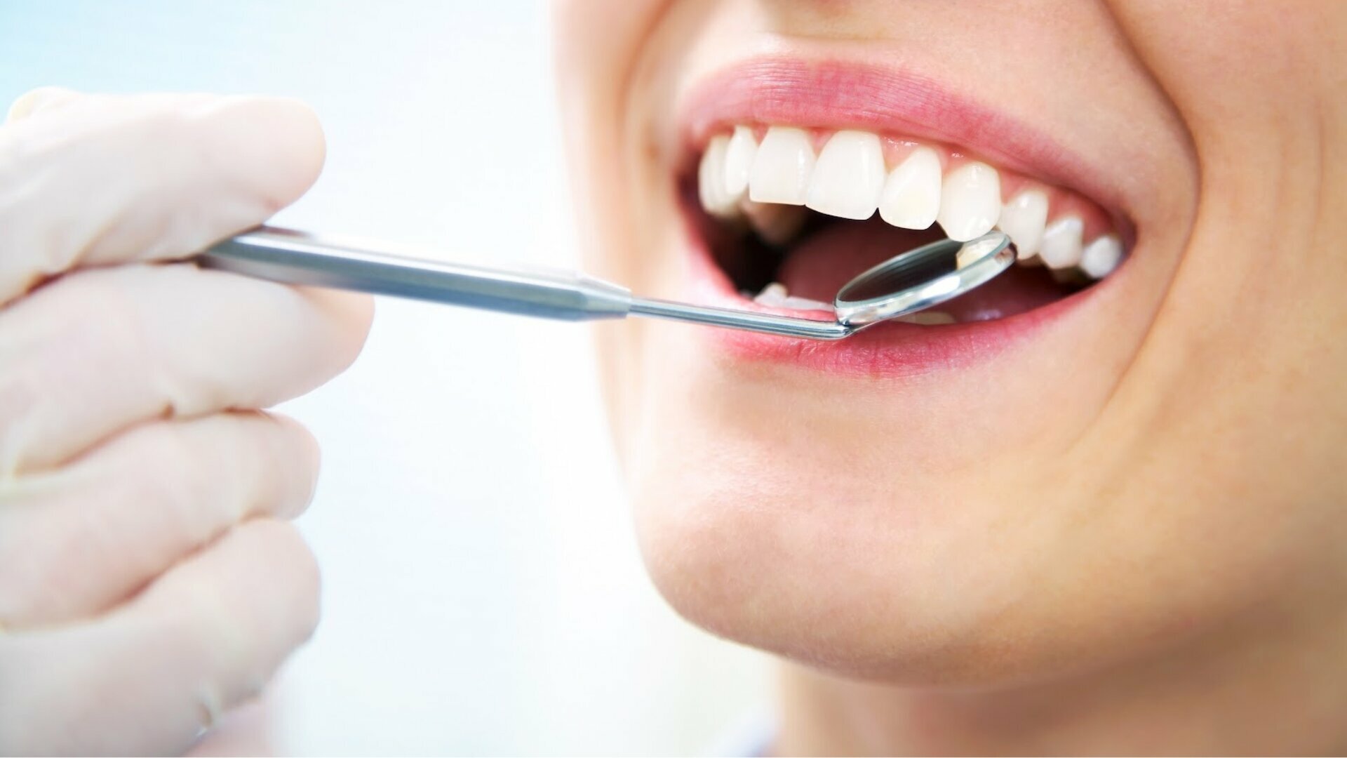 Protocole de traitement canalaire